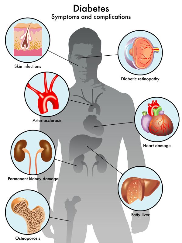 Diabetes Diagram